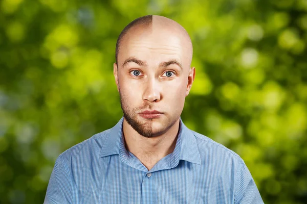 Porträt Mann vor und nach Haarausfall, Transplantation auf grünem Bokeh-Hintergrund. Gespaltene Persönlichkeit. — Stockfoto