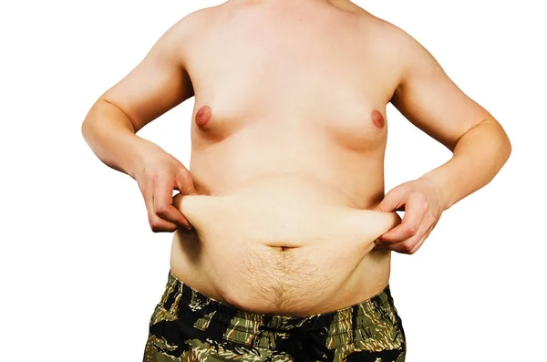초과 중량을 가진 젊은 남자의 몸, 흰색 배경에 고립 된 배꼽 지방을 유지. — 스톡 사진