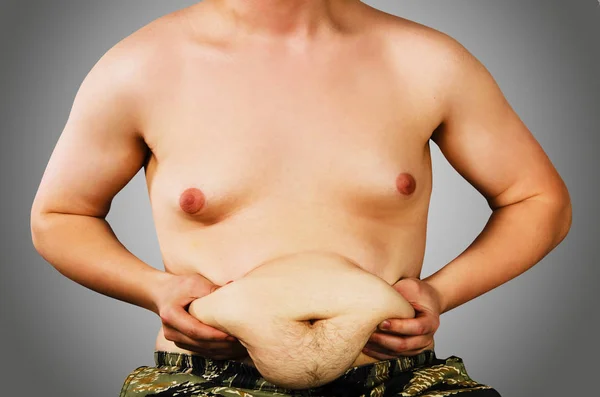 Kroppen av ung man med övervikt, hålla magen fett, på en grå bakgrund. — Stockfoto