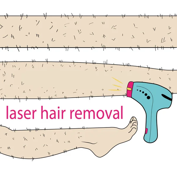 Esboço desenhado em vetor: mulher remove o cabelo das pernas peludas com depilação a laser em um fundo isolado — Vetor de Stock