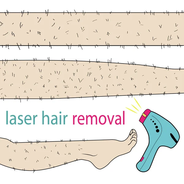 Esboço desenhado em vetor: mulher remove o cabelo das pernas peludas com depilação a laser em um fundo isolado — Vetor de Stock