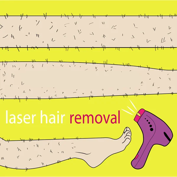 Sketch drawn in vector: woman removes hair from hairy legs with laser hair removal on an isolated background — Stock Vector