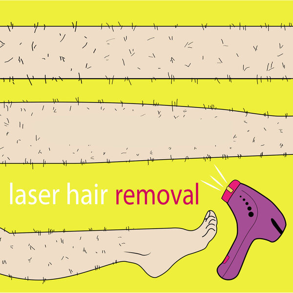 Sketch drawn in vector: woman removes hair from hairy legs with laser hair removal on an isolated background