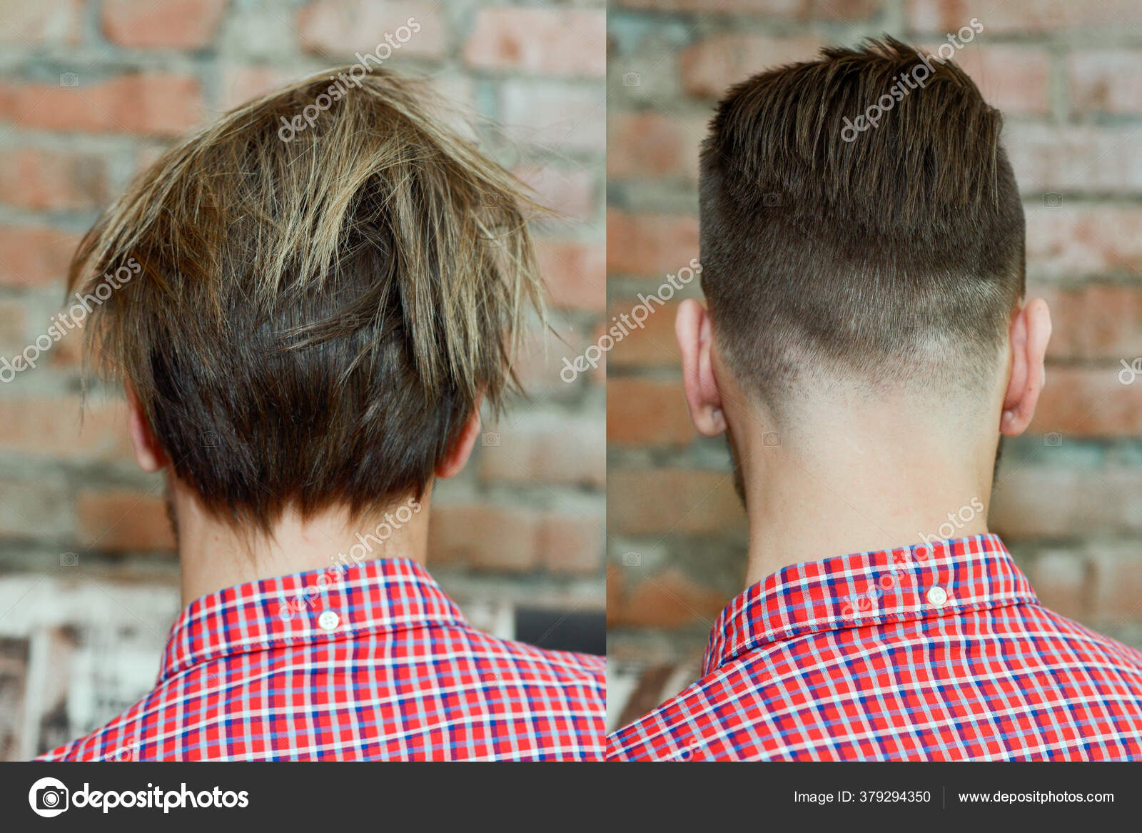 Guy Arter Haircut Hair Loss Transplant Transformation Stock Photo by ©gum92 379294350 Guy Arter Haircut Hair Loss Transplant Transformation Stock Photo by ©gum92 379294350
