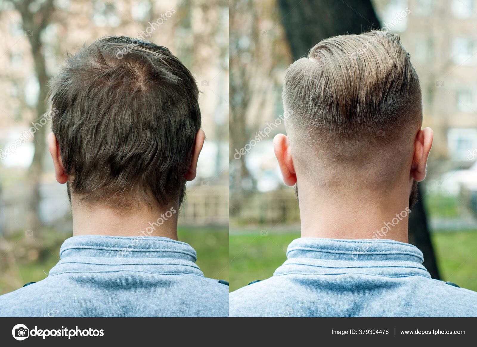 Bald Guy Haircut Concept Barber Shop Problem Man Hair Loss Stock Photo by  ©gum92 379304478