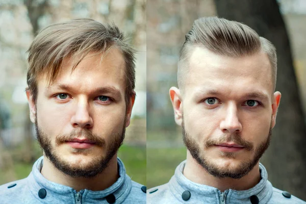 bald guy before after haircut Concept for a barber shop: the problem man of hair loss, alopecia, transplantation.