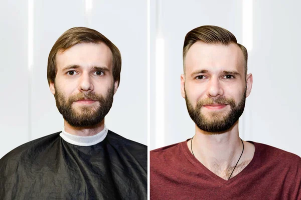 Facet Przed Fryzjerem Koncepcja Fryzjera Problem Człowiek Wypadanie Włosów Łysienie — Zdjęcie stockowe