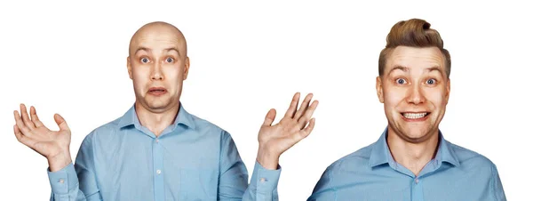 Homem Antes Depois Transplante Cabelo Alopecia Isolado Sobre Fundo Branco — Fotografia de Stock