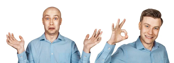 Homem Antes Depois Transplante Cabelo Alopecia Isolado Sobre Fundo Branco — Fotografia de Stock