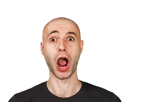 Kafası Karışmış Kel Bir Adam Saç Dökülmesi Saç Dökülmüş Cilt — Stok fotoğraf