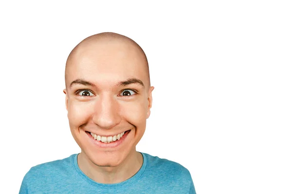 Szczęśliwy Młody Łysy Mężczyzna Łysieniem Facet Skóra Głowa Wypadaniem Włosów — Zdjęcie stockowe