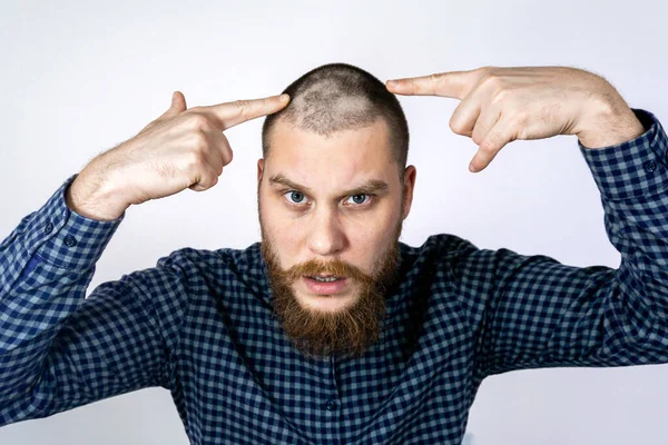 Trauriger Typ Mit Haarausfall Kopf Anrührenden Haaren Und Blicken Den — Stockfoto