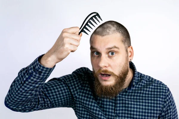 Man Met Alopecia Hoofd Kammen Haar Spot Kaalheid Haar Vallen — Stockfoto