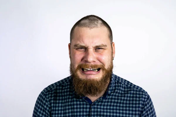 Kafasında Saç Dökülmesi Olan Üzgün Adam Ağla Benek Kelliği Saç — Stok fotoğraf