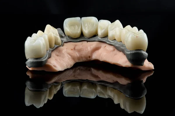 Dental implant mockup closeup