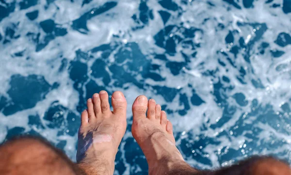 Nohy muže s vitiligem nad mořskou modrou vodou — Stock fotografie