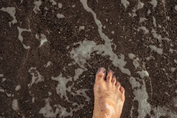 Jambes d'homme avec vitiligo sur la plage de sable — Photo
