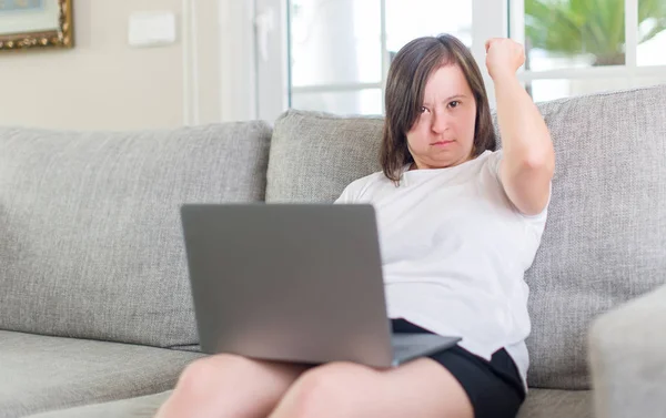 Syndrom Kvinna Hemma Använder Dator Laptop Irriterad Och Frustrerad Skrika — Stockfoto