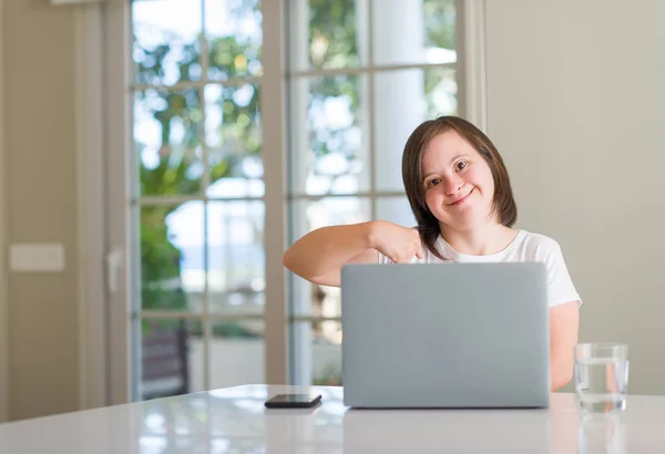 Downs Syndrom Kvinna Hemma Använder Dator Laptop Med Överraskning Ansikte — Stockfoto