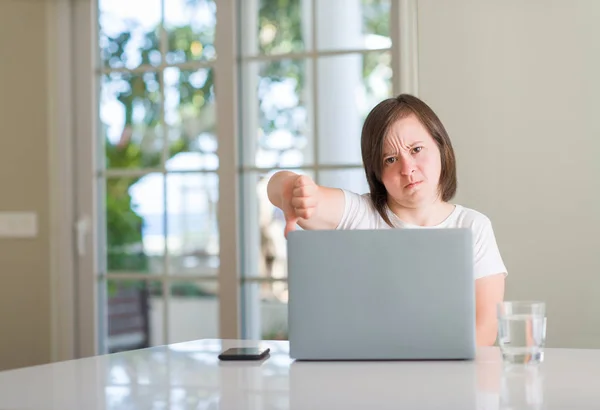 唐氏综合症妇女在家里使用电脑笔记本电脑与愤怒的脸 消极的迹象显示不喜欢拇指向下 拒绝概念 — 图库照片