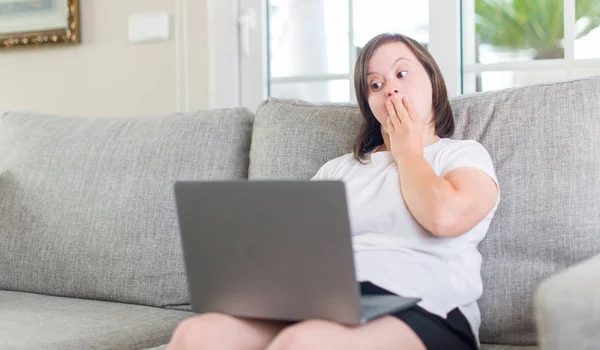 Downs Syndrom Kvinna Hemma Med Dator Laptop Cover Munnen Med — Stockfoto