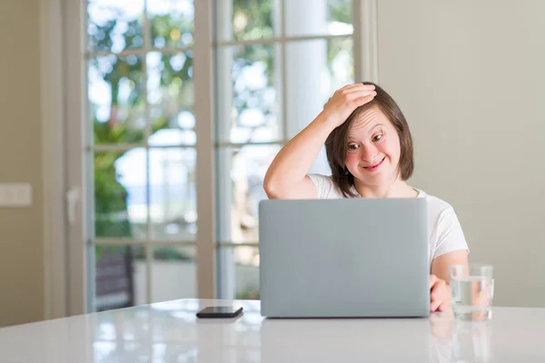 Downs Syndrom Kvinna Hemma Använder Dator Laptop Stressad Med Handen — Stockfoto