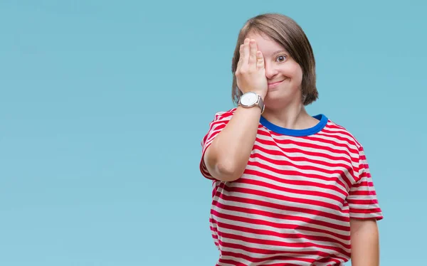 Mladé Dospělé Ženy Downovým Syndromem Izolované Pozadí Zahrnující Jedno Oko — Stock fotografie