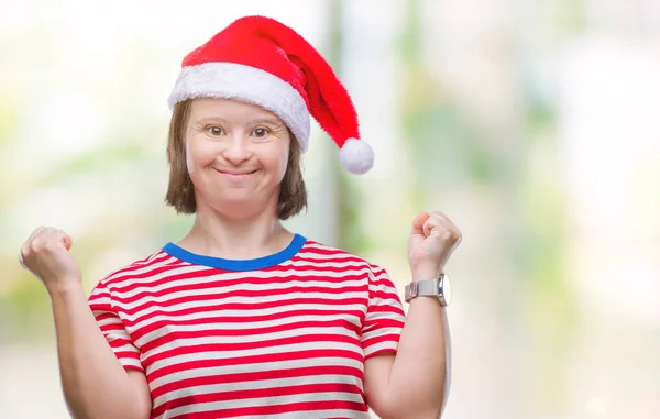 Mulher Adulta Jovem Com Síndrome Usando Chapéu Natal Sobre Fundo — Fotografia de Stock