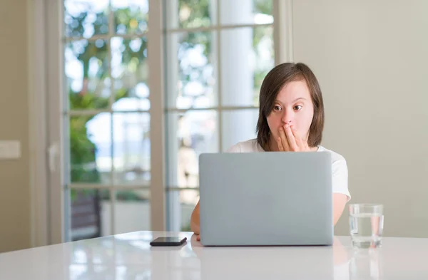 Женщина Синдромом Дауна Дома Использующая Компьютерный Ноутбук Прикрывает Рот Рукой — стоковое фото