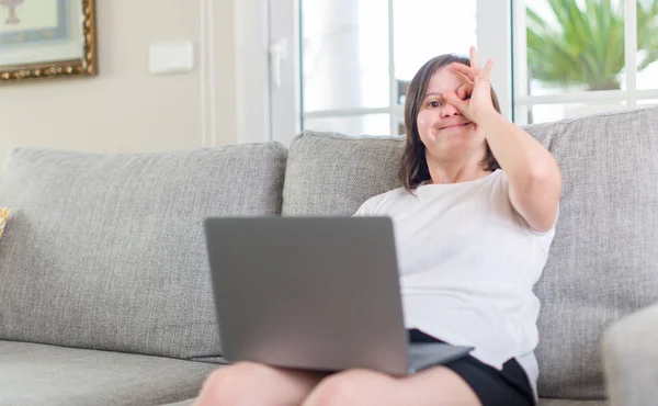 Mulher Síndrome Casa Usando Laptop Computador Com Rosto Feliz Sorrindo — Fotografia de Stock