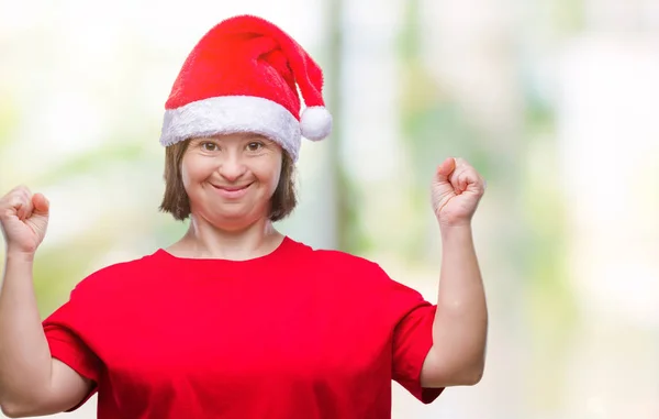 Ung Vuxen Kvinna Med Downs Syndrom Bär Jul Hatt Över — Stockfoto