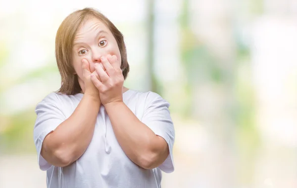 Junge Erwachsene Frau Mit Syndrom Über Isolierten Hintergrund Schockiert Mund — Stockfoto