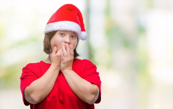 Mulher Adulta Jovem Com Síndrome Usando Chapéu Natal Sobre Fundo — Fotografia de Stock