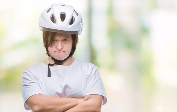 Mujer Joven Ciclista Adulta Con Síndrome Que Lleva Casco Seguridad — Foto de Stock