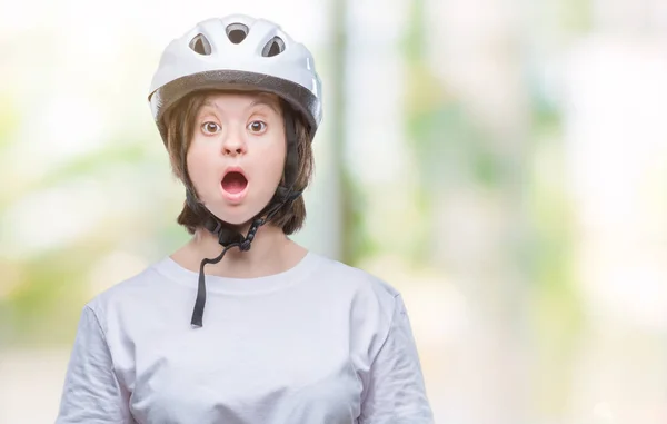 Junge Erwachsene Radfahrerin Mit Syndrom Trägt Schutzhelm Über Isoliertem Hintergrund — Stockfoto