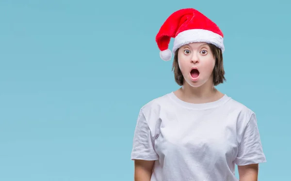 Mujer Adulta Joven Con Síndrome Con Sombrero Navidad Sobre Fondo —  Fotos de Stock