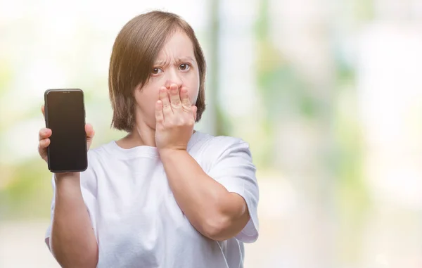 Mulher Adulta Jovem Com Síndrome Mostrando Tela Smartphone Sobre Fundo — Fotografia de Stock