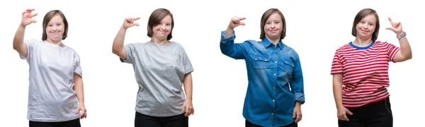 Collage Einer Frau Mit Syndrom Vor Isoliertem Hintergrund Die Lächelt — Stockfoto