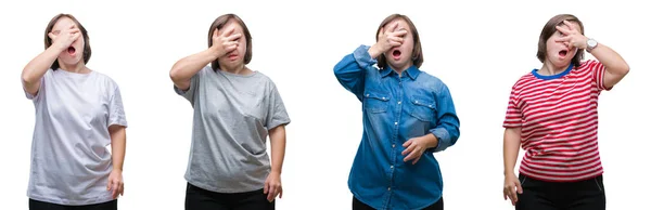 Collage Van Beneden Vrouw Van Sydrome Geïsoleerde Achtergrond Gluren Schok — Stockfoto