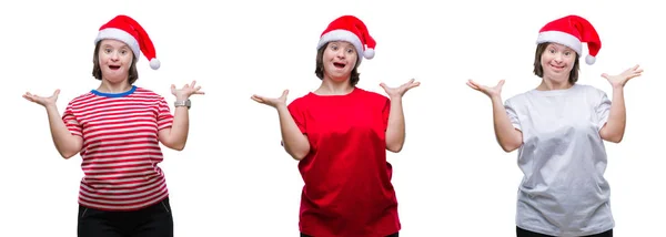 Collage Abajo Mujer Síndrome Usando Sombrero Navidad Sobre Fondo Aislado — Foto de Stock