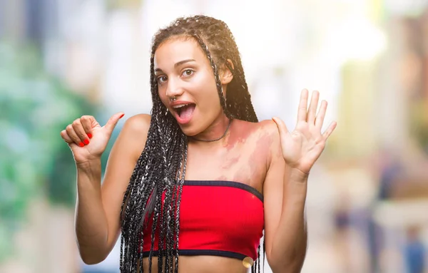 Cabello Trenzado Joven Afroamericano Con Mancha Pigmentación Marca Nacimiento Sobre —  Fotos de Stock