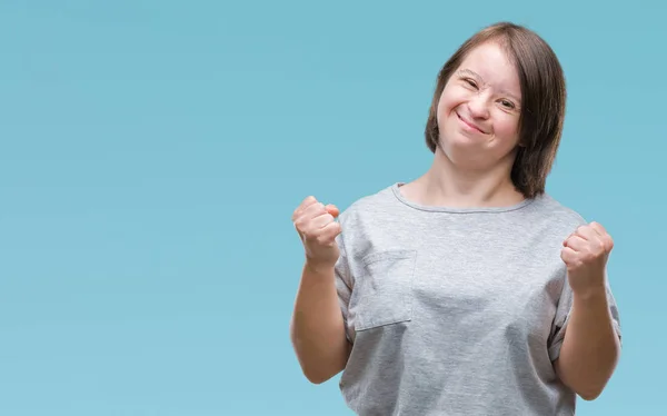 Mujer Adulta Joven Con Síndrome Sobre Fondo Aislado Muy Feliz — Foto de Stock