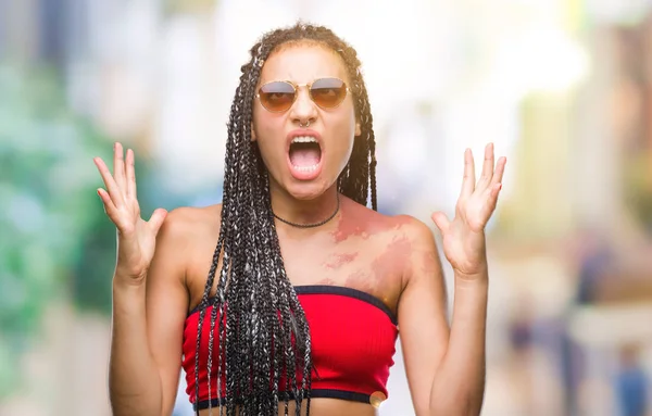 Cabello Trenzado Joven Afroamericano Con Marca Nacimiento Con Gafas Sol — Foto de Stock