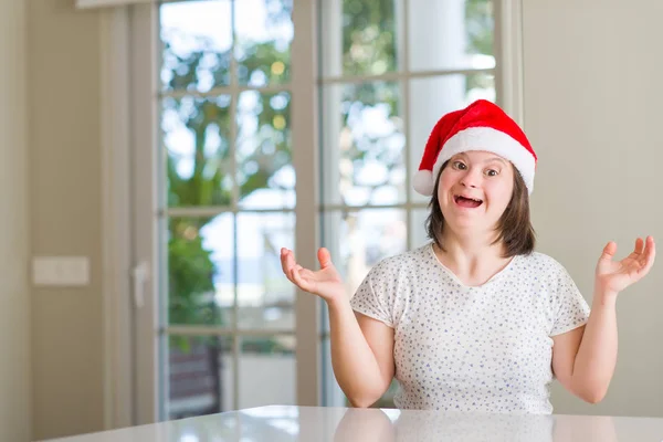 ダウン症女性家で叫んで笑顔で勝利を祝ってクリスマス帽子非常に幸せと興奮 受賞式を身に着けていると手を上げた — ストック写真