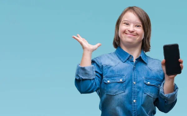 Mujer Adulta Joven Con Síndrome Mostrando Pantalla Del Teléfono Inteligente — Foto de Stock