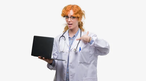 Young Redhead Doctor Woman Holding Computer Laptop Surprise Face Pointing — Stock Photo, Image