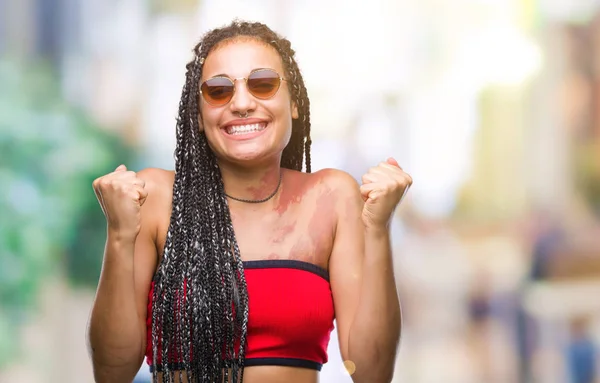 Cabello Trenzado Joven Afroamericano Con Marca Nacimiento Con Gafas Sol —  Fotos de Stock