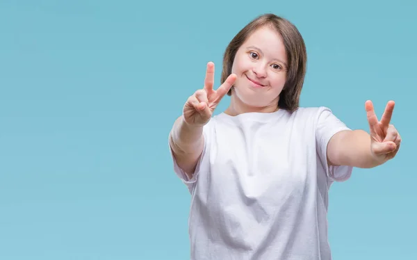 Mujer Adulta Joven Con Síndrome Sobre Fondo Aislado Sonriendo Mirando — Foto de Stock