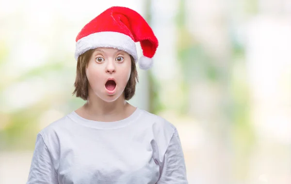 Mulher Adulta Jovem Com Síndrome Usando Chapéu Natal Sobre Fundo — Fotografia de Stock