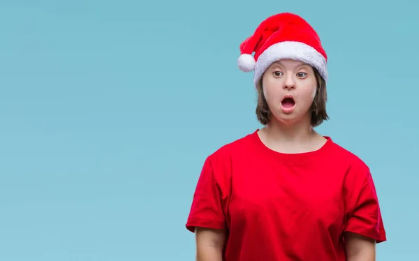 Mulher Adulta Jovem Com Síndrome Usando Chapéu Natal Sobre Fundo — Fotografia de Stock